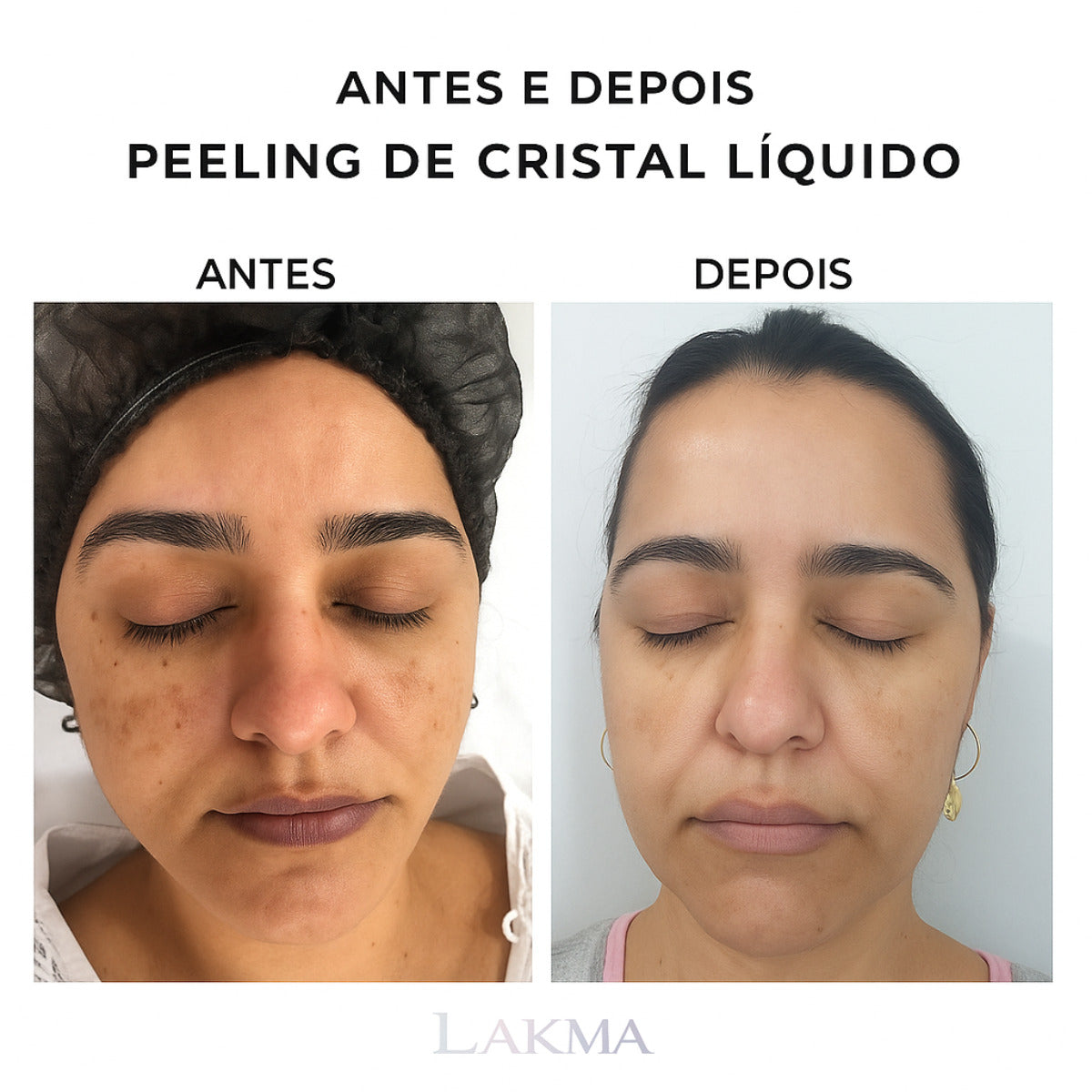 PEELING DE CRISTAL LIQUIDO - 30g LAKMA
